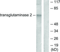 Anti-Transglutaminase 2, N-Terminal antibody produced in rabbit affinity isolated antibody