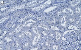 Anti-SMN Antibody, clone 2B1 ZooMAb® Mouse Monoclonal recombinant, expressed in HEK 293 cells