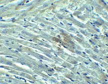 Anti-RIG-1 antibody produced in rabbit purified antibody (DEAE)