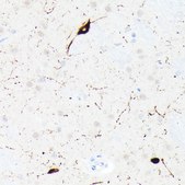 Anti-Somatostatin (SST) Antibody, clone 7Q4T0, Rabbit Monoclonal
