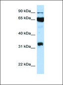 Anti-PTGS1 (AB1) antibody produced in rabbit affinity isolated antibody