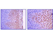 Anti-Laminin gamma 1 Antibody, clone A5 clone A5, Chemicon®, from rat