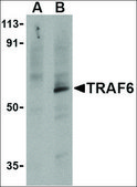 Anti-TRAF6 antibody produced in rabbit IgG fraction of antiserum, buffered aqueous solution