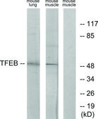 抗-TFEB 兔抗 affinity isolated antibody