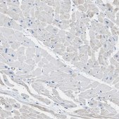 Anti-MYH11 antibody produced in rabbit Prestige Antibodies® Powered by Atlas Antibodies, affinity isolated antibody, buffered aqueous glycerol solution
