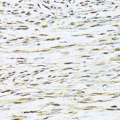 Anti-KU70 antibody produced in rabbit