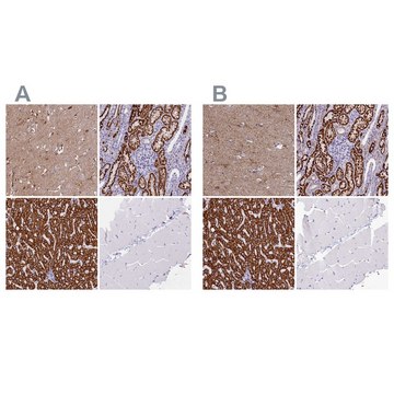 Anti-ABAT antibody produced in rabbit Prestige Antibodies® Powered by Atlas Antibodies, affinity isolated antibody, buffered aqueous glycerol solution