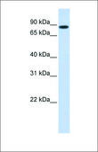 Anti-STAT5B (ab2) antibody produced in rabbit affinity isolated antibody