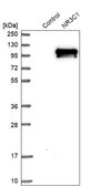 Anti-NR3C1 antibody produced in rabbit Prestige Antibodies® Powered by Atlas Antibodies, affinity isolated antibody, buffered aqueous glycerol solution