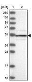 Anti-STK17A antibody produced in rabbit Prestige Antibodies® Powered by Atlas Antibodies, affinity isolated antibody, buffered aqueous glycerol solution