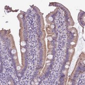 Anti-ALDH2 antibody produced in rabbit Prestige Antibodies® Powered by Atlas Antibodies, affinity isolated antibody, buffered aqueous glycerol solution