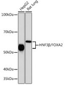 Anti-HNF3β/FOXA2 Antibody, clone 9O4M2, Rabbit Monoclonal