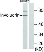 Anti-Involucrin antibody produced in rabbit affinity isolated antibody