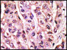 Anti-SUMO4 (V55 Mutant) antibody produced in rabbit saturated ammonium sulfate (SAS) precipitated, buffered aqueous solution