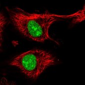 Anti-ZFP91 antibody produced in rabbit Prestige Antibodies® Powered by Atlas Antibodies, affinity isolated antibody