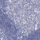 Anti-SLC37A4 antibody produced in rabbit Prestige Antibodies® Powered by Atlas Antibodies, affinity isolated antibody, buffered aqueous glycerol solution