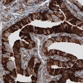 Monoclonal Anti-PDIA3 antibody produced in mouse Prestige Antibodies® Powered by Atlas Antibodies, clone CL2446, purified immunoglobulin, buffered aqueous glycerol solution