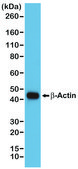 Anti-beta-Actin antibody, Rabbit monoclonal recombinant, expressed in HEK 293 cells, clone RM112, purified immunoglobulin