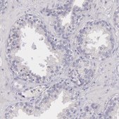 Anti-MYH6 antibody produced in rabbit Prestige Antibodies® Powered by Atlas Antibodies, affinity isolated antibody, buffered aqueous glycerol solution