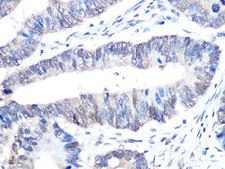 Anti-UBE2I antibody produced in rabbit
