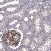 Monoclonal Anti-LAMB2 antibody produced in mouse Prestige Antibodies® Powered by Atlas Antibodies, clone CL2979, purified immunoglobulin, buffered aqueous glycerol solution