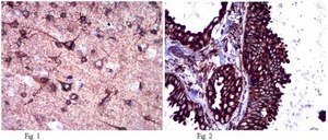 抗钙结合蛋白抗体 from rabbit, purified by affinity chromatography