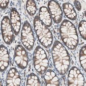 Anti-RAD54B antibody produced in rabbit Prestige Antibodies® Powered by Atlas Antibodies, affinity isolated antibody, buffered aqueous glycerol solution