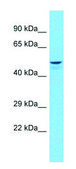 Anti-ADRB1 (C-terminal) antibody produced in rabbit affinity isolated antibody