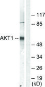 抗-AKT 兔抗 affinity isolated antibody