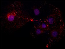 抗 硫酸软骨素抗体，小鼠单克隆 clone CS-56, purified from hybridoma cell culture