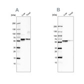 Anti-SERPINA1 antibody produced in rabbit Prestige Antibodies® Powered by Atlas Antibodies, affinity isolated antibody, buffered aqueous glycerol solution