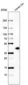 Monoclonal Anti-B3GAT1 antibody produced in mouse Prestige Antibodies® Powered by Atlas Antibodies, clone CL9499, purified immunoglobulin, buffered aqueous glycerol solution