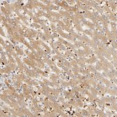 Anti-AGT antibody produced in rabbit Prestige Antibodies® Powered by Atlas Antibodies, affinity isolated antibody, buffered aqueous glycerol solution