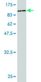 Monoclonal Anti-PGM3 antibody produced in mouse clone 1E2-1B12, purified immunoglobulin, buffered aqueous solution