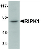 Anti-RIPK1 antibody produced in rabbit affinity isolated antibody, buffered aqueous solution