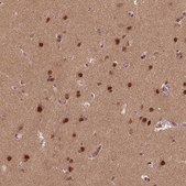 Anti-BRD9 antibody produced in rabbit Prestige Antibodies® Powered by Atlas Antibodies, affinity isolated antibody