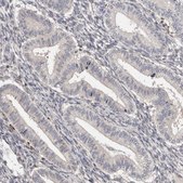 Anti-TNNI1 antibody produced in rabbit Prestige Antibodies® Powered by Atlas Antibodies, affinity isolated antibody, buffered aqueous glycerol solution