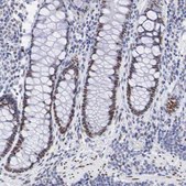 Anti-FOXP2 antibody produced in rabbit AB1, Prestige Antibodies® Powered by Atlas Antibodies, affinity isolated antibody, buffered aqueous glycerol solution