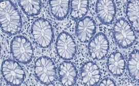 Anti-IQGAP1 Antibody, clone 4M20 ZooMAb® Rabbit Monoclonal recombinant, expressed in HEK 293 cells