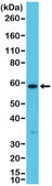 Anti-Cytokeratin 10 (CK-10) antibody, Rabbit monoclonal recombinant, expressed in HEK 293 cells, clone RM386, purified immunoglobulin
