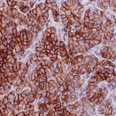 Monoclonal Anti-CA12 antibody produced in mouse Prestige Antibodies® Powered by Atlas Antibodies, clone CL0280, purified immunoglobulin, buffered aqueous glycerol solution