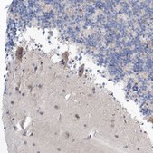 Anti-GABRG1 antibody produced in rabbit Prestige Antibodies® Powered by Atlas Antibodies, affinity isolated antibody, buffered aqueous glycerol solution