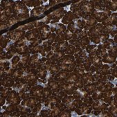 Anti-P4HB antibody produced in rabbit Prestige Antibodies® Powered by Atlas Antibodies, affinity isolated antibody, buffered aqueous glycerol solution