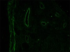 Monoclonal Anti-Desmin antibody produced in mouse clone DE-U-10, ascites fluid