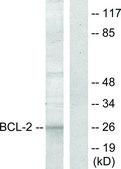 Anti-BCL-2 antibody produced in rabbit affinity isolated antibody