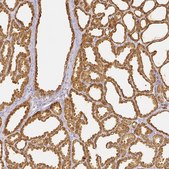 Anti-LALBA antibody produced in rabbit Prestige Antibodies® Powered by Atlas Antibodies, affinity isolated antibody