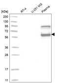 Anti-SERPINC1 antibody produced in rabbit Prestige Antibodies® Powered by Atlas Antibodies, affinity isolated antibody, buffered aqueous glycerol solution