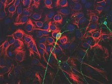 抗β III微管蛋白抗体 Chemicon®, from chicken