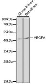 Anti-VEGF antibody produced in rabbit