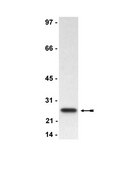Anti-Bcl2 Antibody, clone 100 clone 100, Upstate®, from mouse